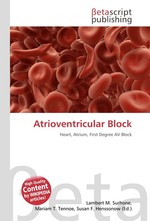 Atrioventricular Block