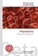 Angioplasty