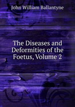 The Diseases and Deformities of the Foetus, Volume 2