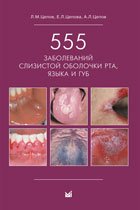 555 заболеваний слизистой оболочки рта, языка и губ