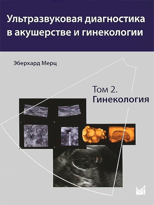 Ультразвуковая диагностика в акушерстве и гинекологии. В 2 томах. Том 2. Гинекология