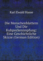 Die Menschenblattern Und Die Kuhpockenimpfung: Eine Geschichtliche Skizze (German Edition)