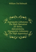 Suprapubic Lithotomy: The High Operation for Stone, Epicystotomy, Hypogastric Lithotomy (The High Apparatus)