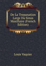 De La Trepanation Large Du Sinus Maxillaire (French Edition)
