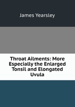 Throat Ailments: More Especially the Enlarged Tonsil and Elongated Uvula