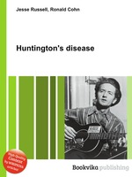 Huntington`s disease