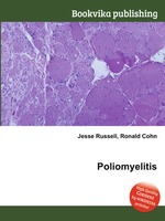 Poliomyelitis