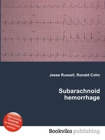 Subarachnoid hemorrhage