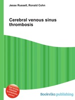 Cerebral venous sinus thrombosis