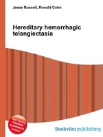 Hereditary hemorrhagic telangiectasia