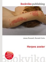 Herpes zoster