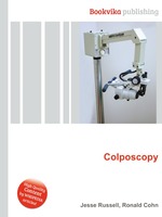 Colposcopy