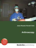 Arthroscopy