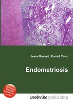 Endometriosis