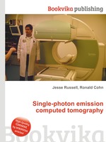 Single-photon emission computed tomography