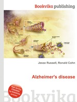 Alzheimer`s disease