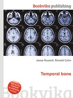 Temporal bone