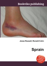 Sprain