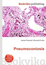 Pneumoconiosis