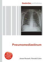 Pneumomediastinum