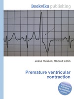 Premature ventricular contraction