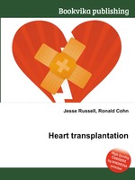 Heart transplantation