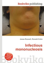 Infectious mononucleosis