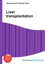 Liver transplantation