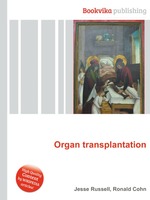 Organ transplantation