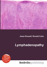 Lymphadenopathy