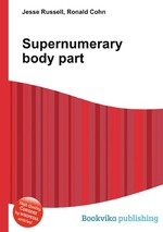 Supernumerary body part