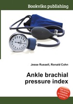 Ankle brachial pressure index