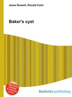 Baker`s cyst