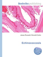 Echinococcosis