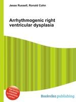 Arrhythmogenic right ventricular dysplasia