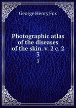 Photographic atlas of the diseases of the skin. v. 2 c. 2. 3