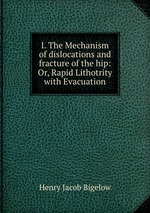 I. The Mechanism of dislocations and fracture of the hip: Or, Rapid Lithotrity with Evacuation