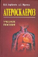 Атеросклероз
