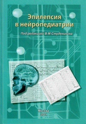 Эпилепсия в нейропедиатрии