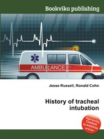 History of tracheal intubation