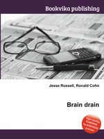Brain drain