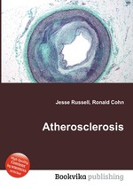 Atherosclerosis