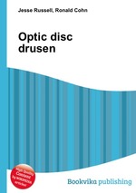 Optic disc drusen