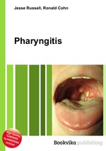 Pharyngitis