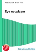 Eye neoplasm