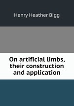 On artificial limbs, their construction and application