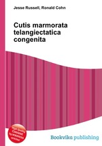 Cutis marmorata telangiectatica congenita