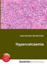 Hypercalcaemia