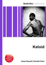 Keloid