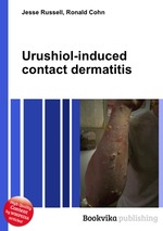 Urushiol-induced contact dermatitis